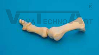 Hallux toe